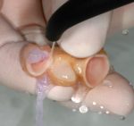 Ivoclean Refill 5g - Image 3