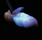 Bluephase G4 100-240V - Image 3