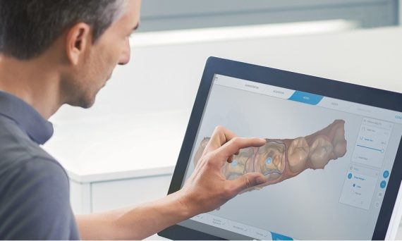 Cerec Software Cerec Software, Cerec Primemill, Digital Dentistry